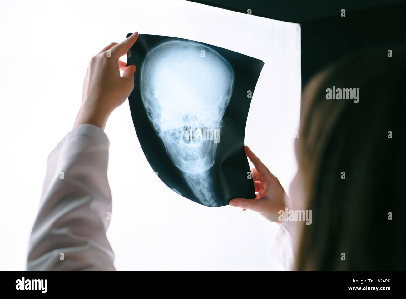 Femme médecin à la recherche de x-ray film de tête humaine, femme en examinant l'intérieur de l'hôpital médical de dépistage radiographique du crâne de l'image Banque D'Images