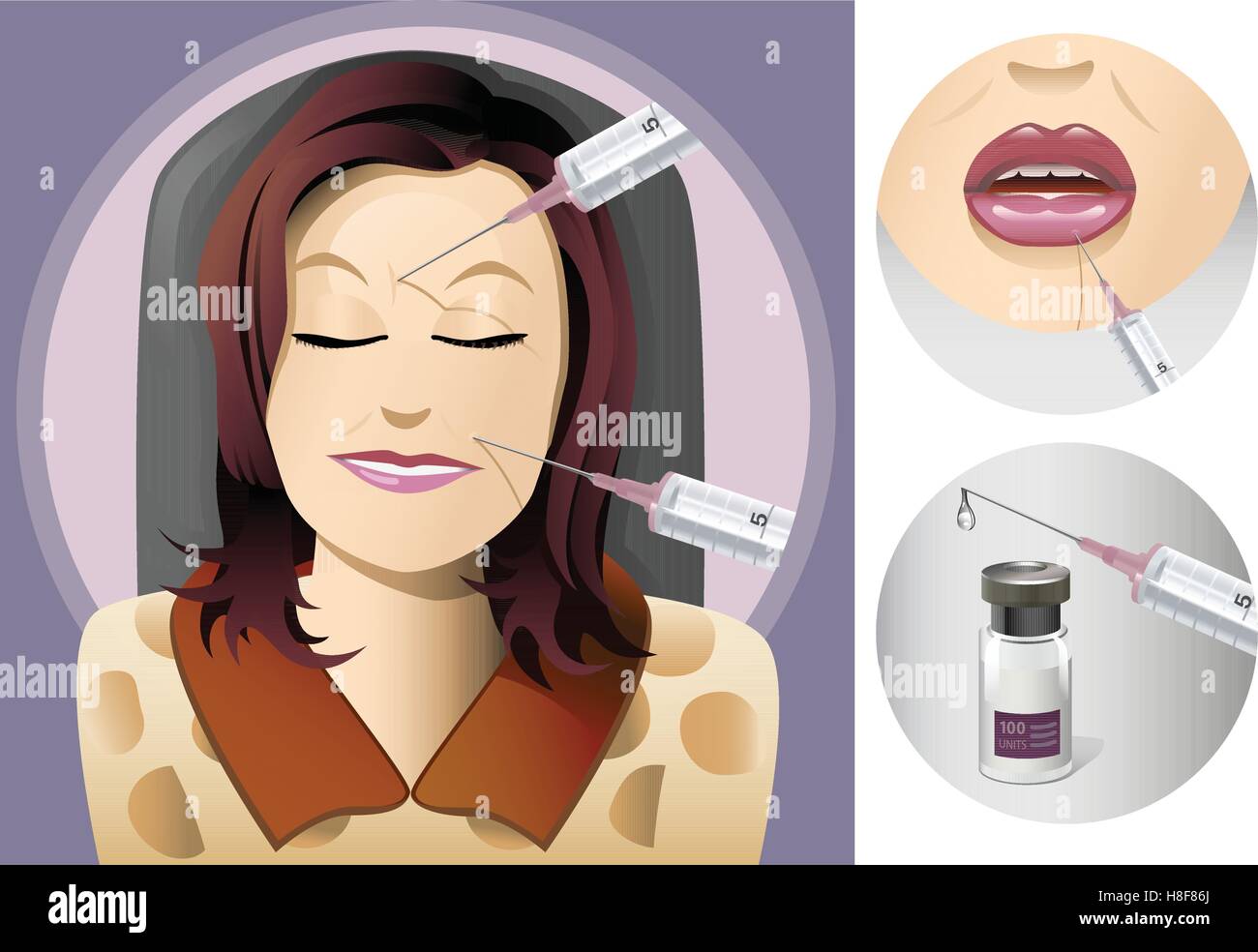 Femme d'âge moyen d'obtenir un traitement pour le visage avec des lèvres et d'une seringue gros plan Illustration de Vecteur