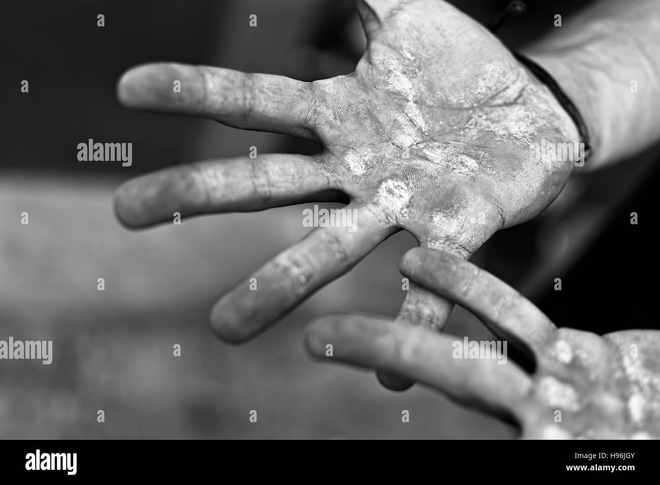 Palms avec durillons. Ampoules aux mains les blessés de travail manuel. Travail difficile Concept. Banque D'Images