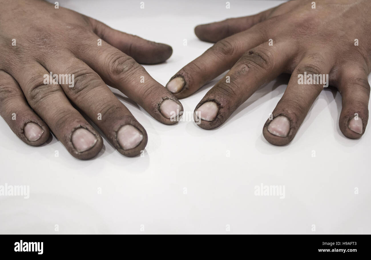 Les mains de l'homme souillé de graisse et de saleté, de travail Banque D'Images