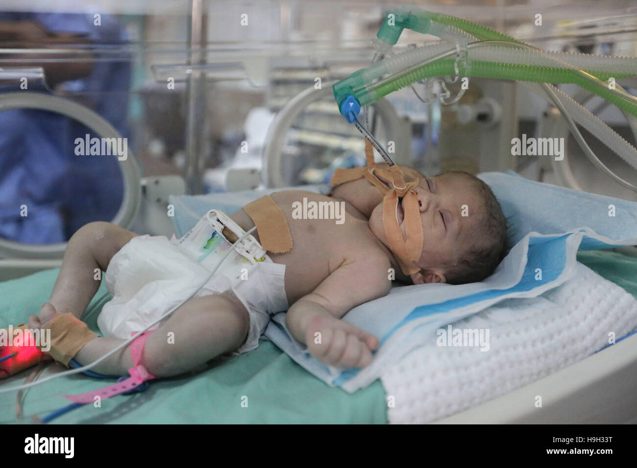 La bande de Gaza. 23 Nov, 2016. Un jour des jumeaux conjoints palestiniens résident dans un incubateur à la pépinière le 23 novembre 2016 à al-l'hôpital Shifa à Gaza City. © Wissam Nassar/Xinhua/Alamy Live News Banque D'Images