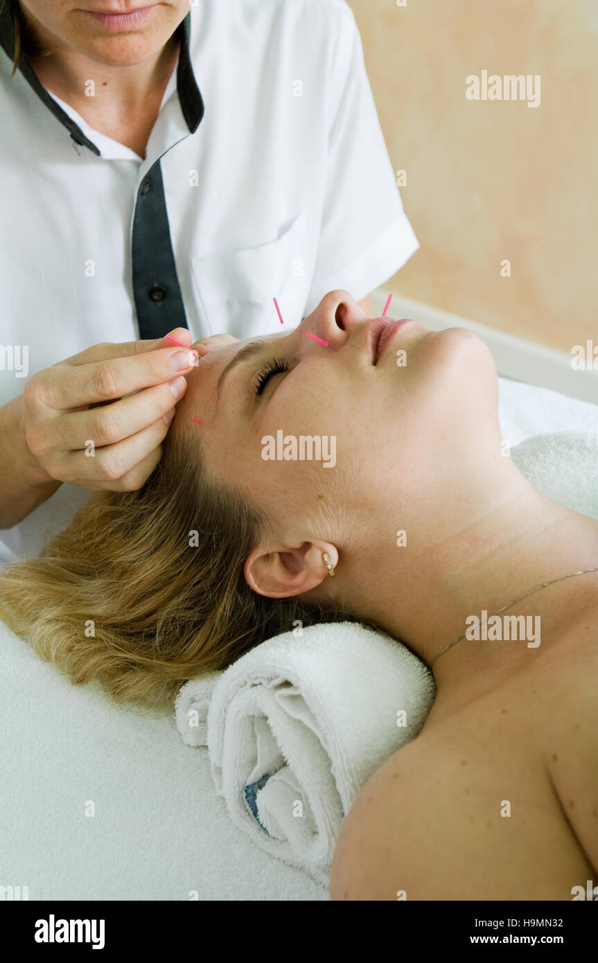 Femme qui reçoit un traitement d'acupuncture à Santa Lucia, hôtel et spa Resort, centre de thérapie, des Caraïbes Banque D'Images