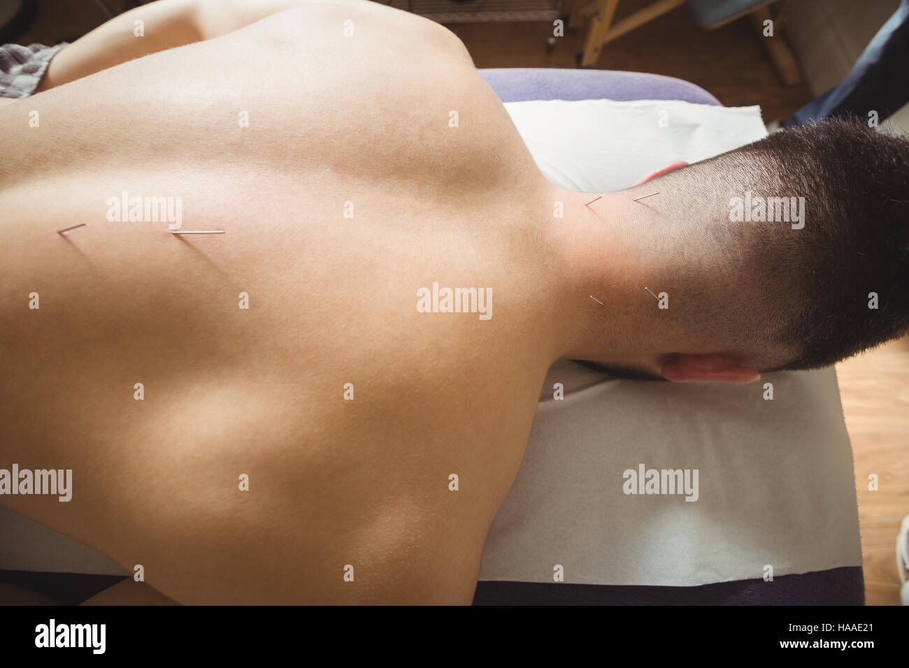 Patient qui aiguille sèche à l'arrière Banque D'Images