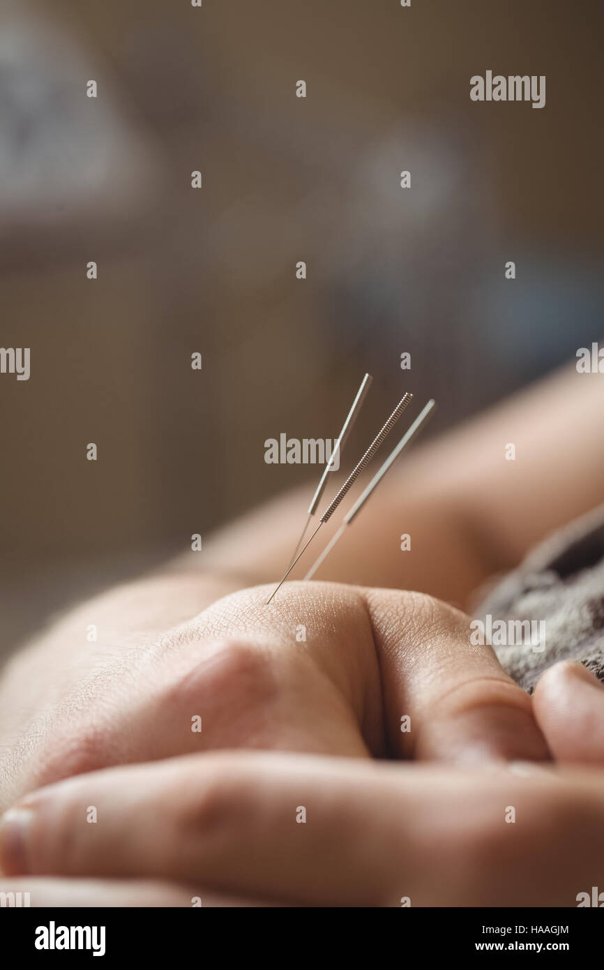 Patient qui aiguille sèche en main Banque D'Images
