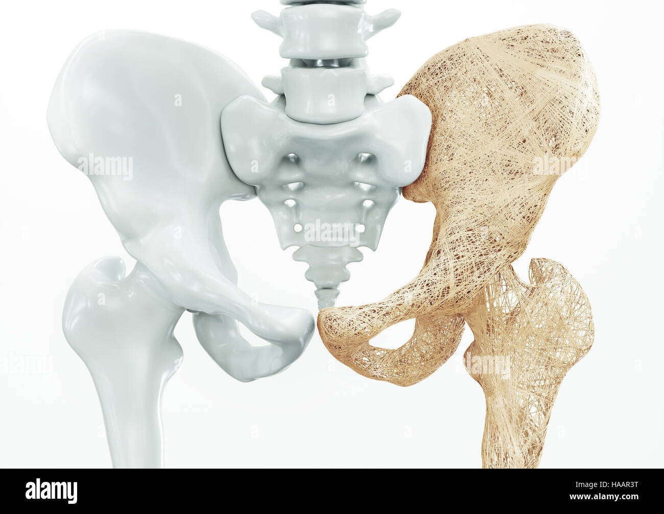 L'ostéoporose - les os du membre supérieur - le rendu 3D Banque D'Images