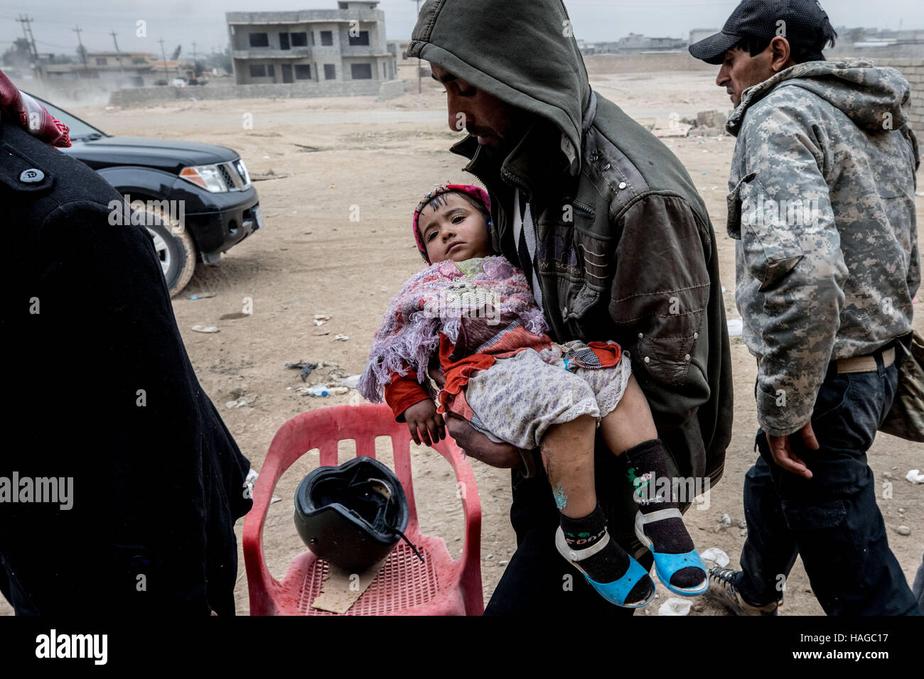 Mossoul, Ninive, Province de l'Irak. 30Th Nov, 2016. Un enfant est élevé dans le domaine de l'hôpital dans Gogjali avec brûlures à ses jambes. Crédit : Gabriel Romero/ZUMA/Alamy Fil Live News Banque D'Images