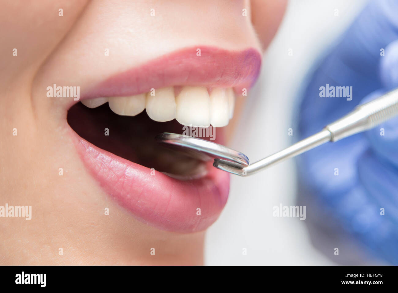 Vue rapprochée d'ouvrir la bouche pendant l'examen oral chez le dentiste Banque D'Images