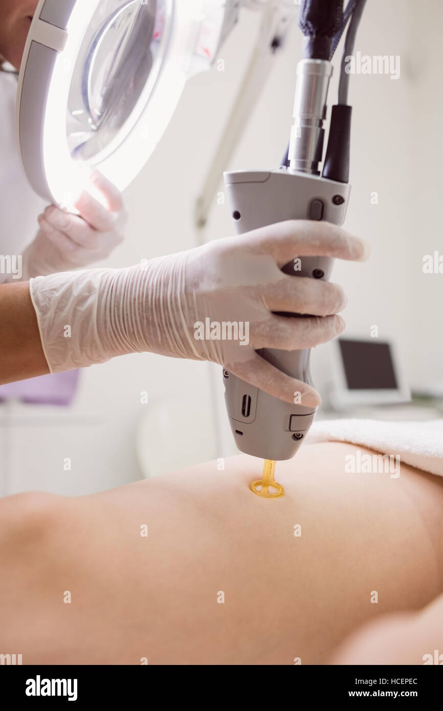 Médecin effectuant l'enlèvement de cheveux de laser sur la peau du patient en clinique Banque D'Images