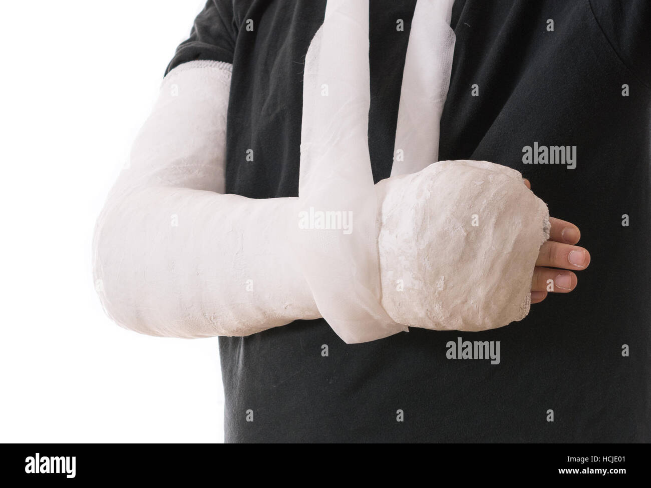 Blanc brillant - moulage du bras en bras long cast dans une écharpe pour un  coude, le bras cassé, ou le poignet. Couverts en plâtre du bras / plâtre /  fibre de
