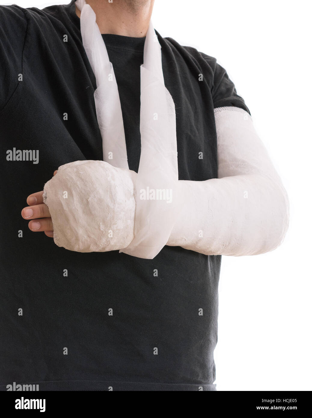 Blanc brillant - moulage du bras en bras long cast dans une écharpe pour un  coude, le bras cassé, ou le poignet. Couverts en plâtre du bras / plâtre /  fibre de