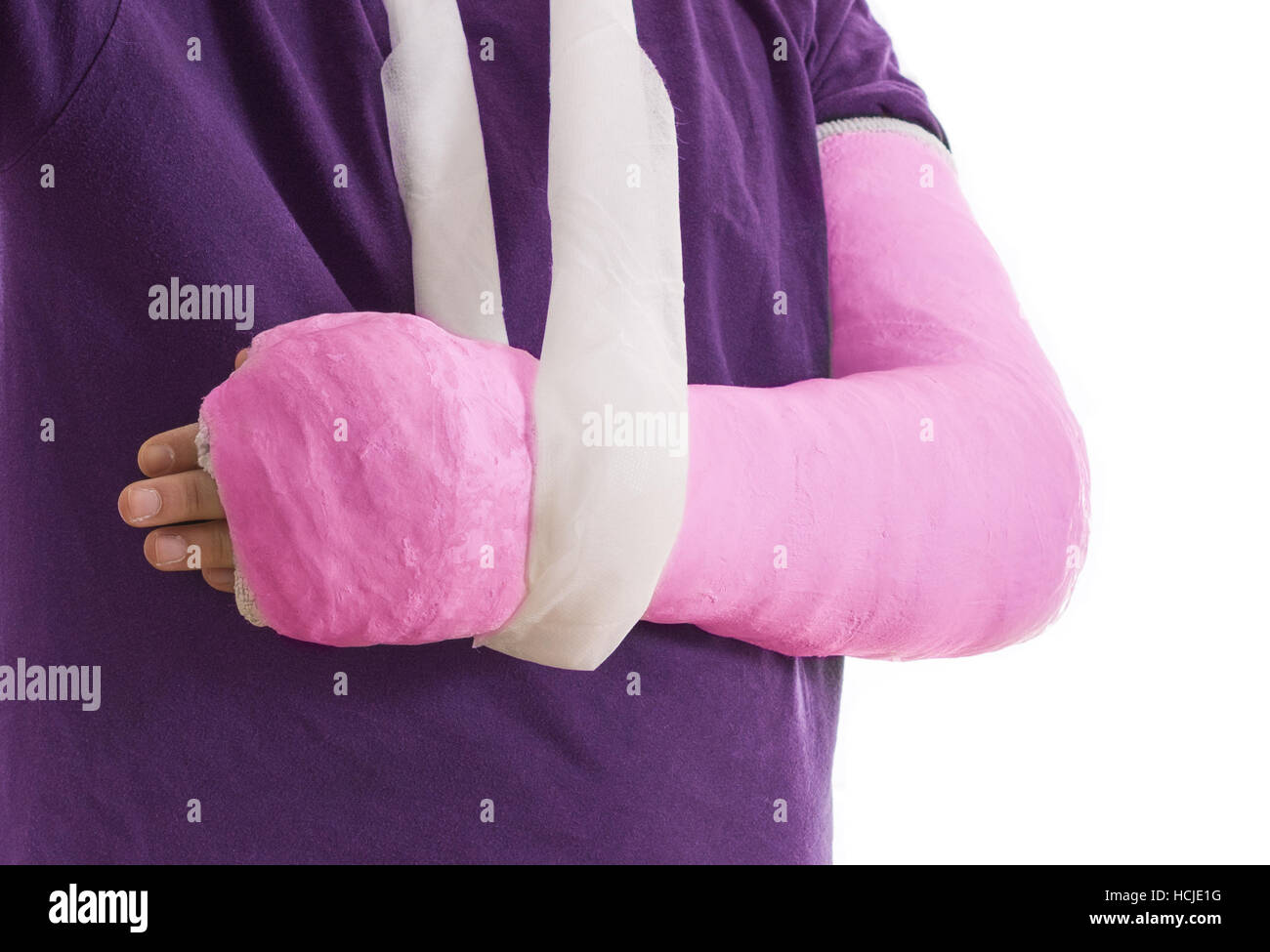 Rose vif moulage du bras en bras long cast dans une écharpe pour un coude, le bras cassé, ou