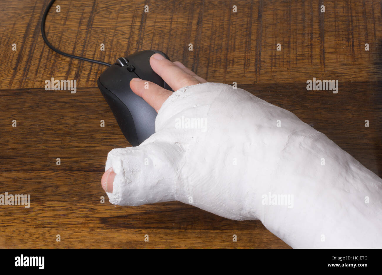 Une personne portant un bras jeté après avoir cassé le poignet des difficultés à utiliser une souris d'ordinateur Banque D'Images