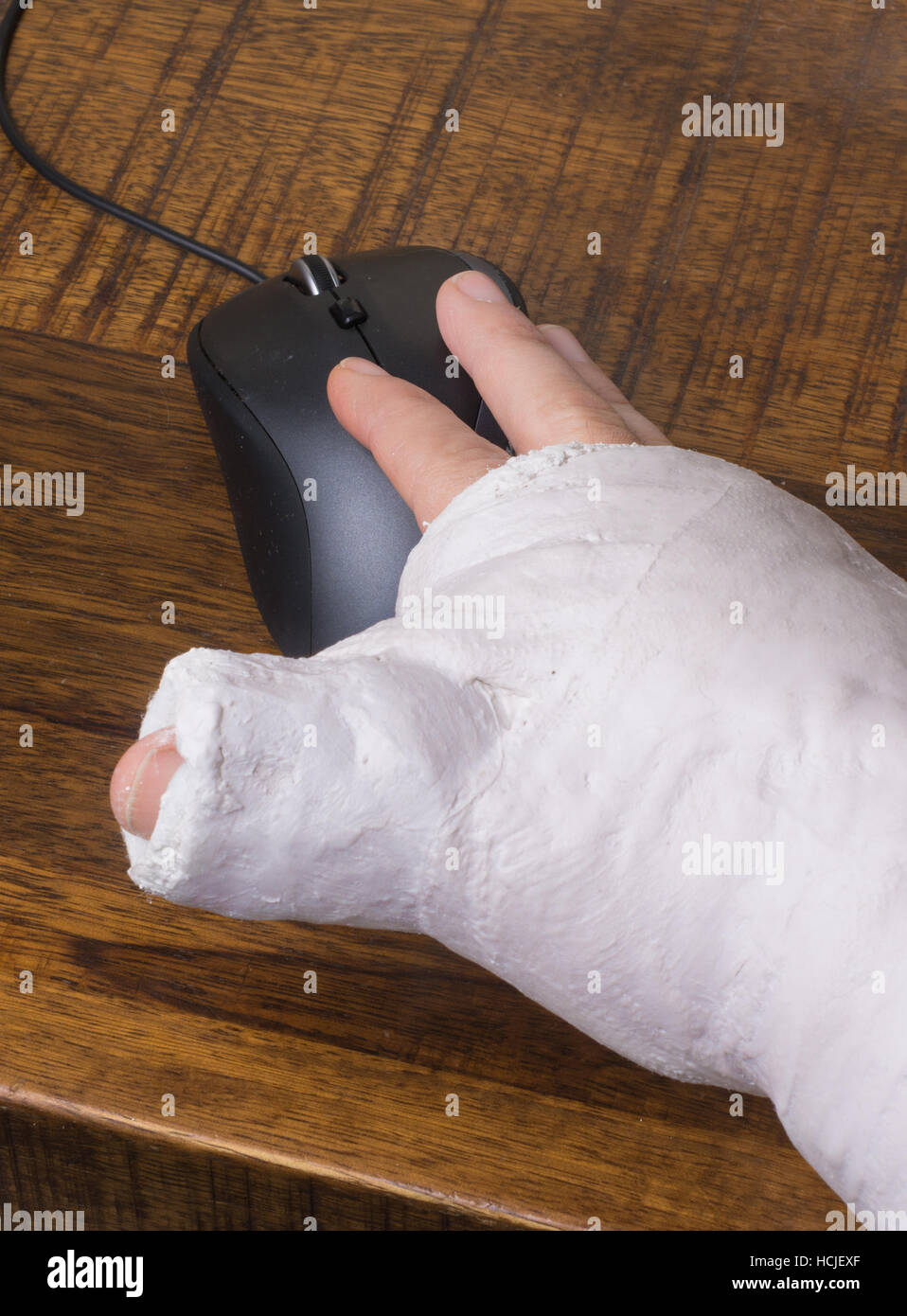 Une personne portant un bras jeté après avoir cassé le poignet des difficultés à utiliser une souris d'ordinateur Banque D'Images