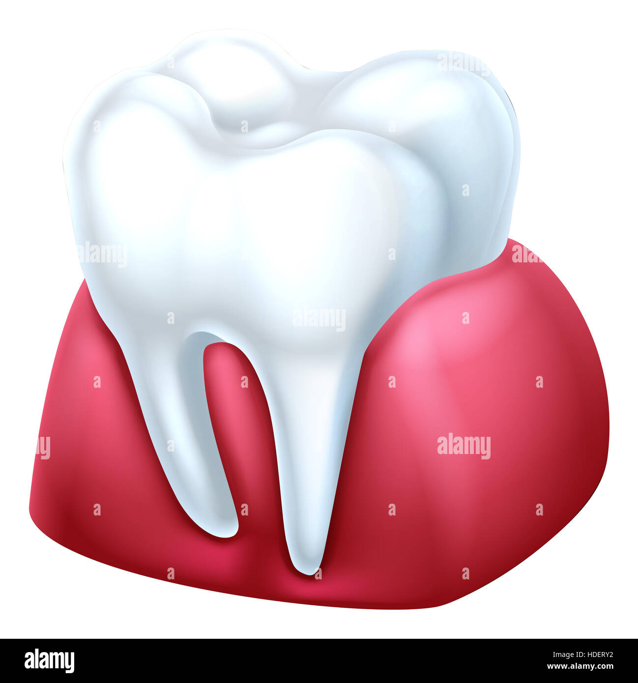 Une illustration médicale dentaire d'une dent et la gencive Banque D'Images