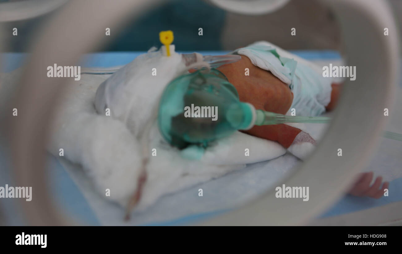 7 Decembre 16 Un Bebe Premature Livre Avec Une Naissance Par Cesarienne Dans Un Hopital De Maarat An Numan Sa Mere Avait Ete Blesse Dans Un Bombardement Au Populaire Marche De Maarat 7 Decembre 16 Un Bebe Premature Livre Avec Une Naissance Par Cesarienne Dans Un Hopital De Maarat An Numan Sa Mere Avait Ete Blesse Dans Un Bombardement Au Populaire Marche De Maarat