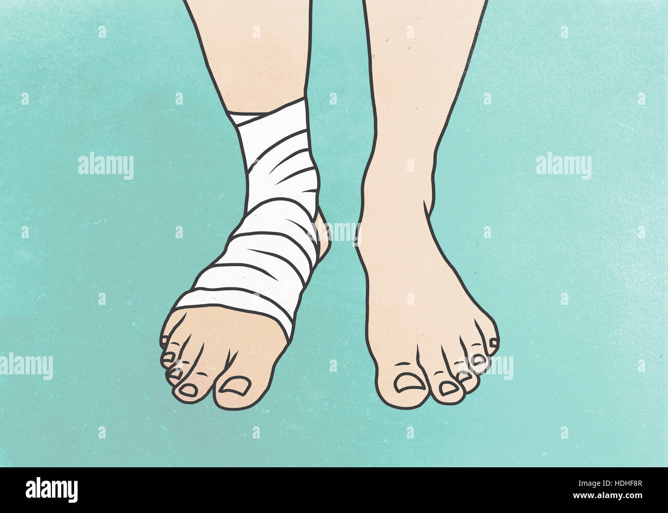 Illustration de jambe avec un bandage sur pied contre l'arrière-plan de couleur Banque D'Images