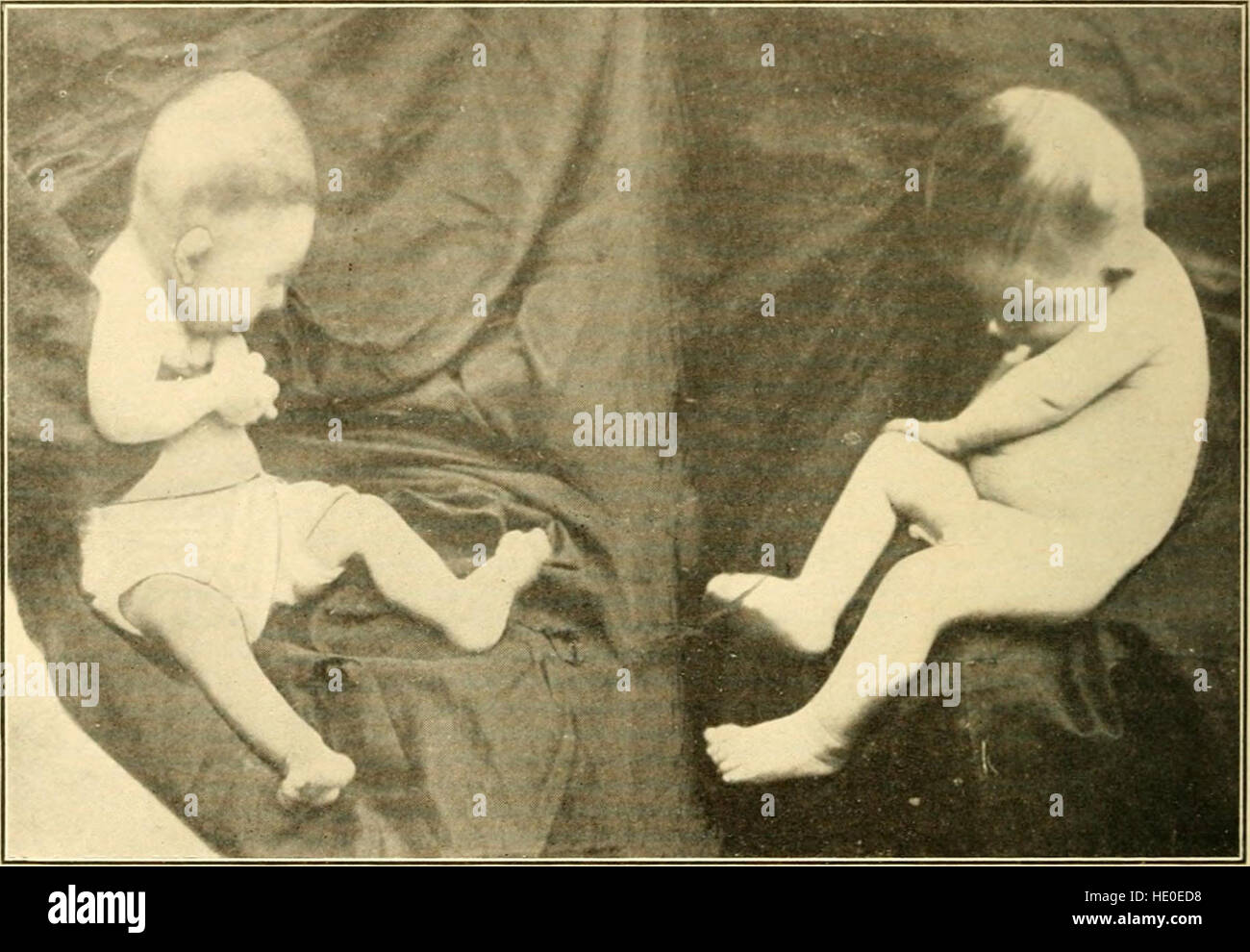 Le diagnostic moderne et le traitement des maladies des enfants ; un traité sur les maladies médicales et chirurgicales de l'enfance et de l'enfance (1911) Banque D'Images