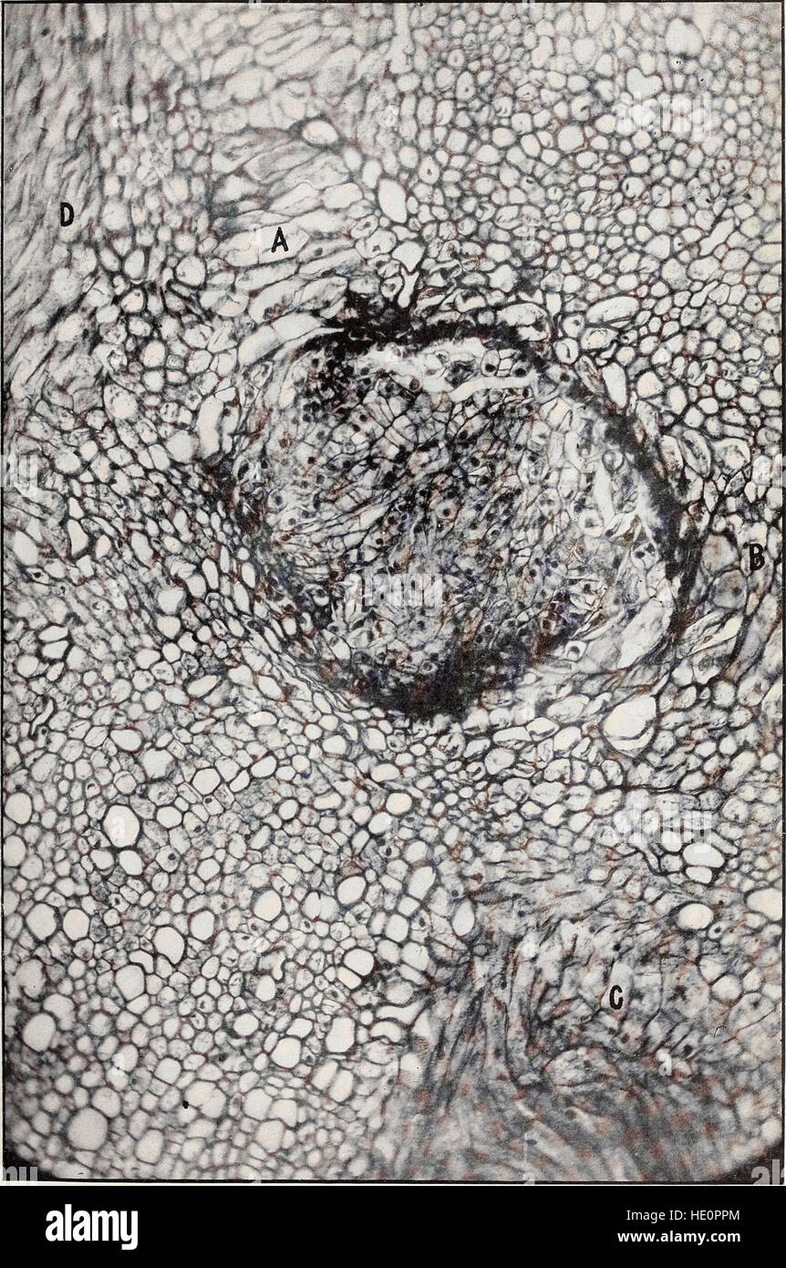 Ce travail de 1912 examine la galle couronnée, une maladie bactérienne qui cause des tumeurs dans les plantes. Il explore les processus biologiques derrière la formation de la maladie et ses effets sur la croissance des plantes. Le livre fournit un aperçu de la pathologie et des mécanismes des cancers des plantes, offrant des informations précieuses pour les pratiques agricoles et la gestion des maladies des plantes. Banque D'Images