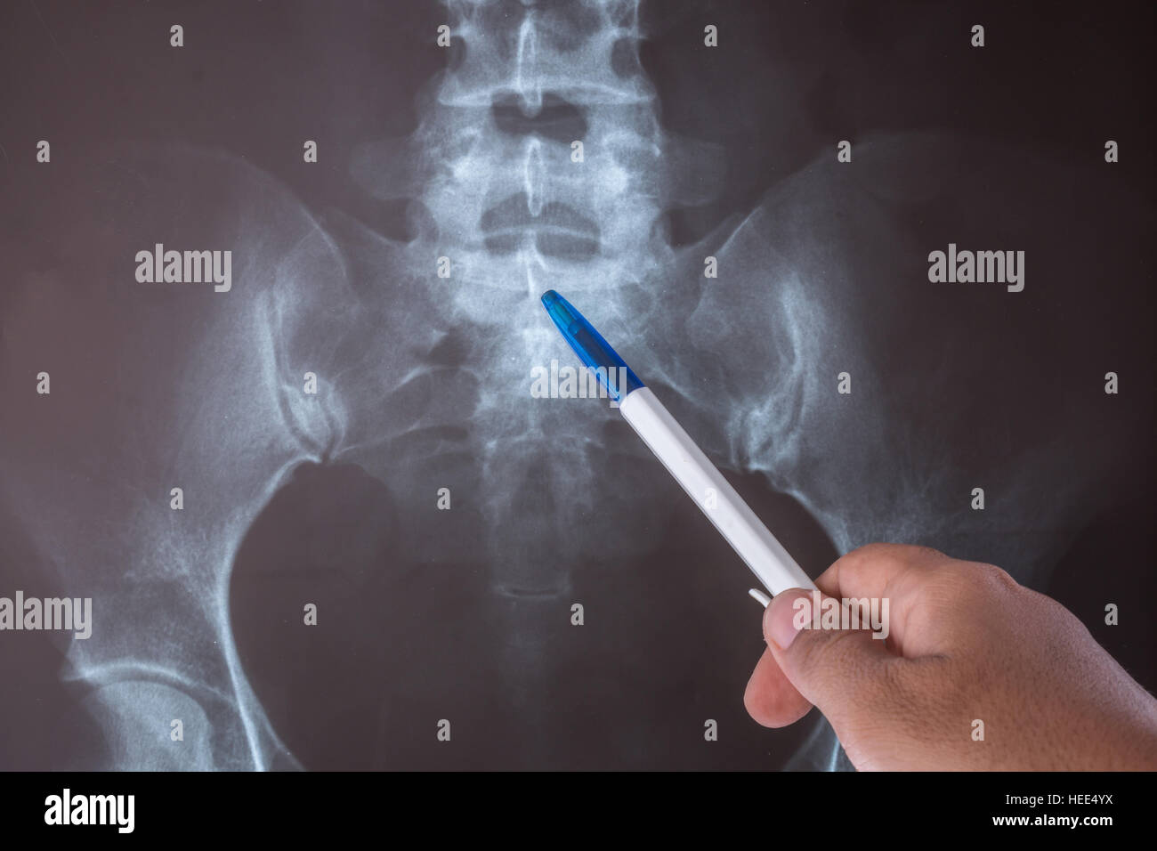Close up X-ray image d'humain pour un diagnostic médical. Banque D'Images