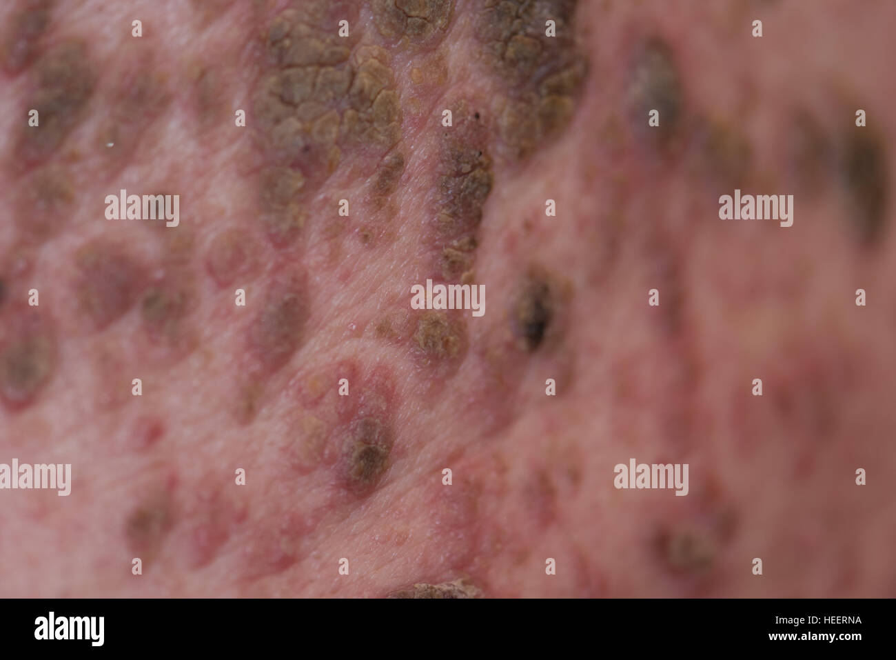 Mans retour à la masse de grains et l'infection Banque D'Images