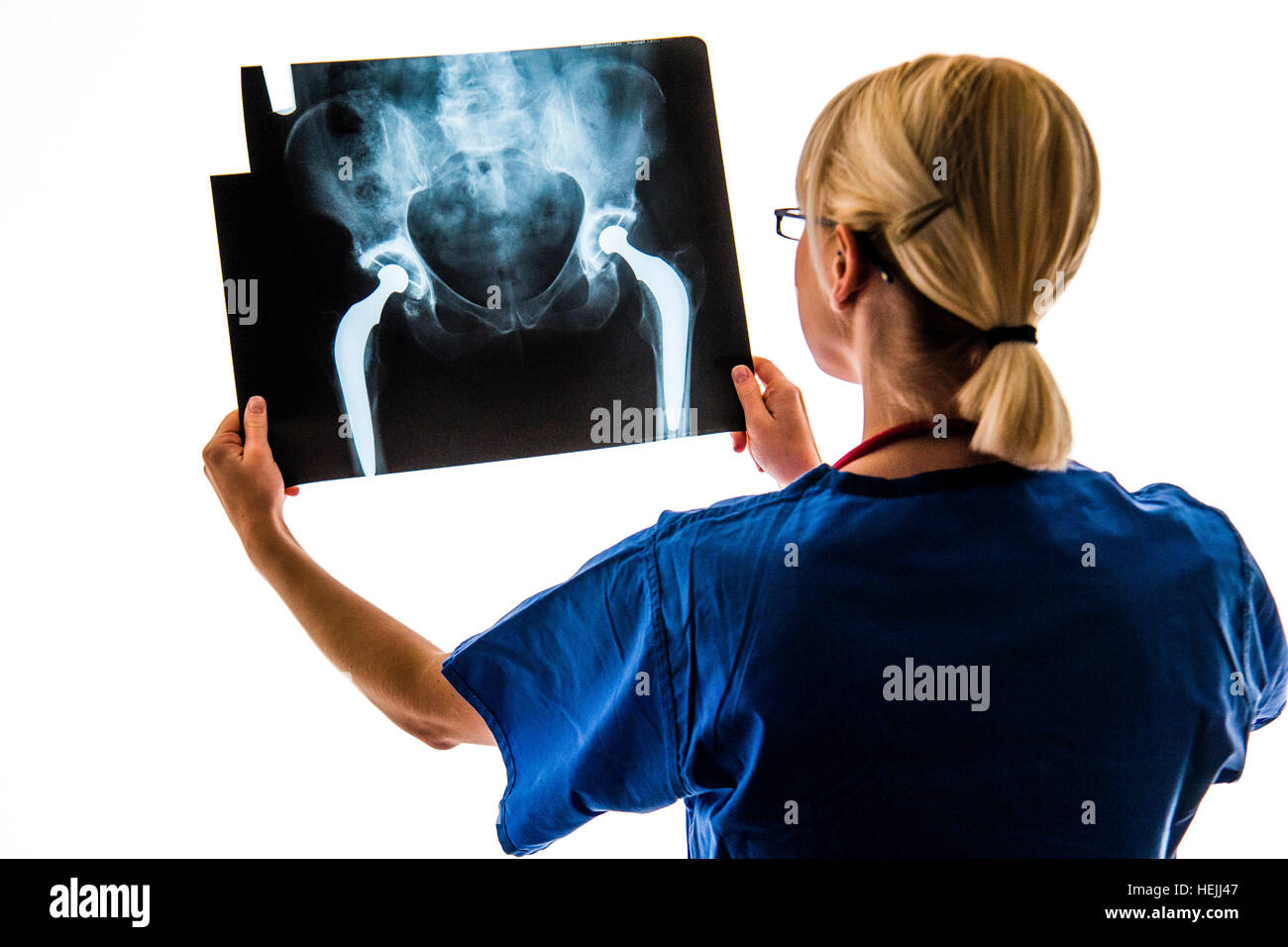 Les professionnels de la Santé du Royaume-Uni : A National Health Service (NHS) Femme recherche femme à un ensemble d'images radiologiques d'une double opération de remplacement de la hanche Banque D'Images
