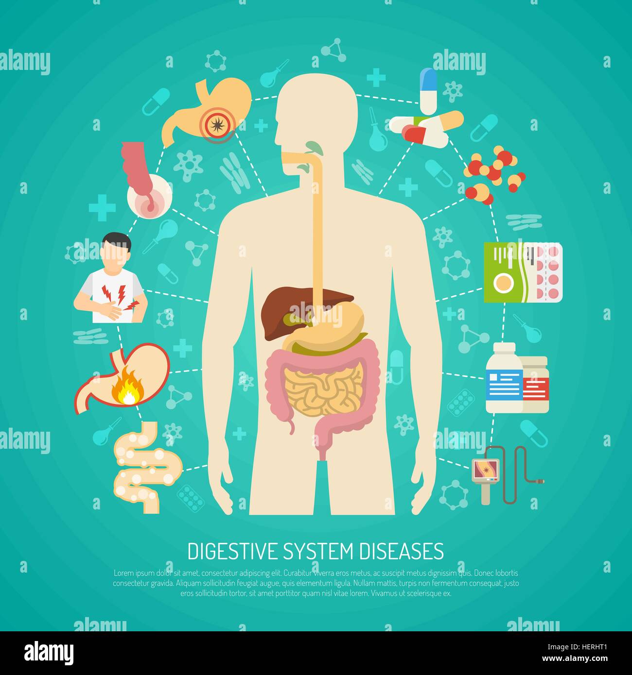 Maladies de l'appareil digestif l'illustration . Maladies du système