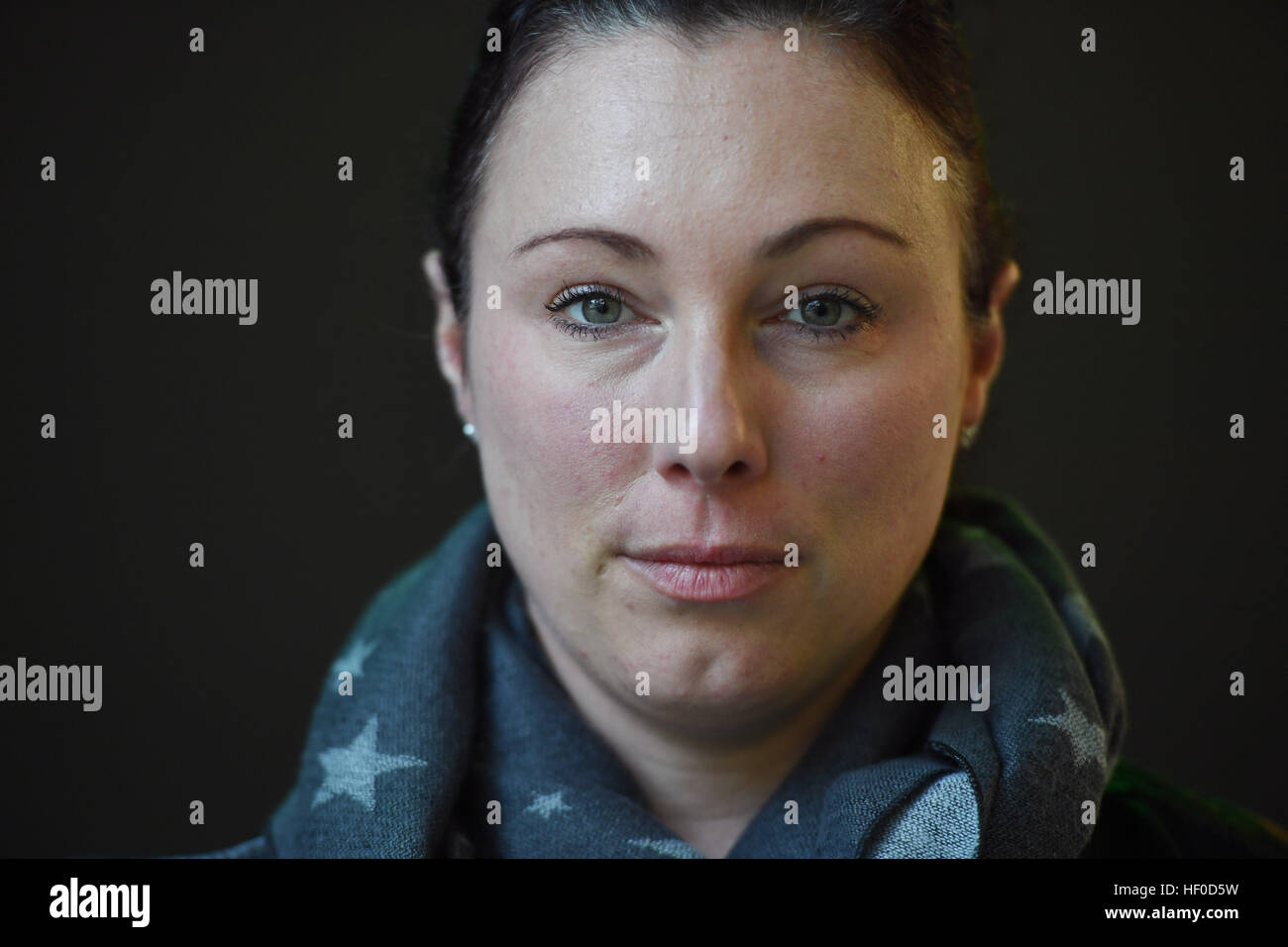 Stuttgart, Gernmany. Le 15 décembre, 2016. Ines Ladig, qui souffre de la maladie auto-immune lupus, à Stuttgart, Gernmany, 15 décembre 2016. Photo : Marijan Murat/dpa/Alamy Live News Banque D'Images
