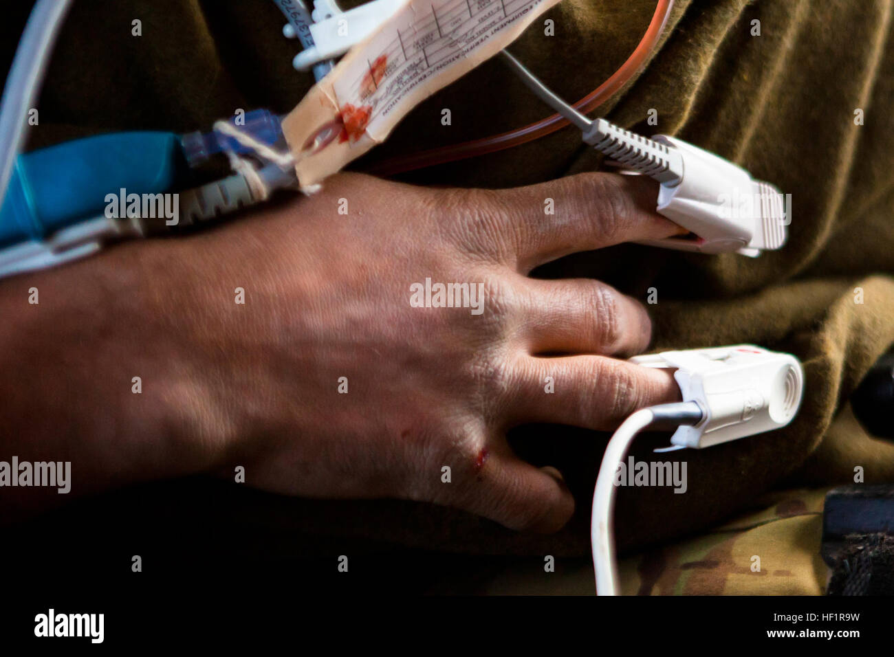 L'équipement de surveillance et les lignes intraveineuses exécuté à partir de la main d'un soldat afghan blessé lors d'un vol d'évacuation médicale à bord d'un UH-60 Black Hawk à Camp Bastion, dans la province d'Helmand, en Afghanistan, le 14 novembre 2013. Les médecins de vol avec la Compagnie Charlie, 1-168ème bataillon de l'aviation d'appui général traité le patient pour une blessure abdominale tout en volant de la base d'opération avancée Delaram II au Camp Bastion. E28098Golden HourE28099 Vol, vitesse infirmiers patients traumatisés off battlefield 131114-M-ZB219-064 Banque D'Images