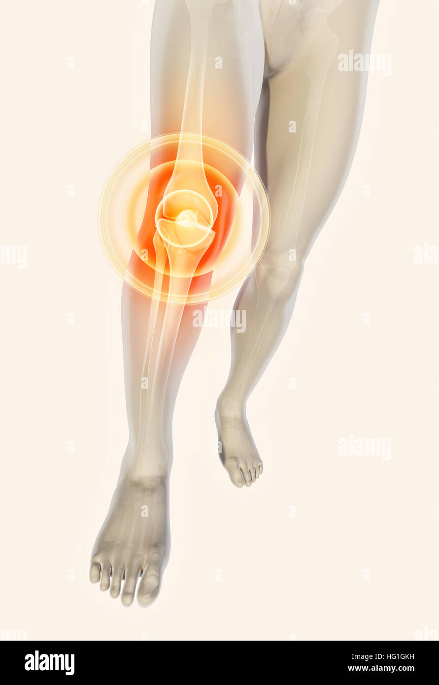 Genou douloureux - skeleton x-ray, 3D Illustration concept médical. Banque D'Images