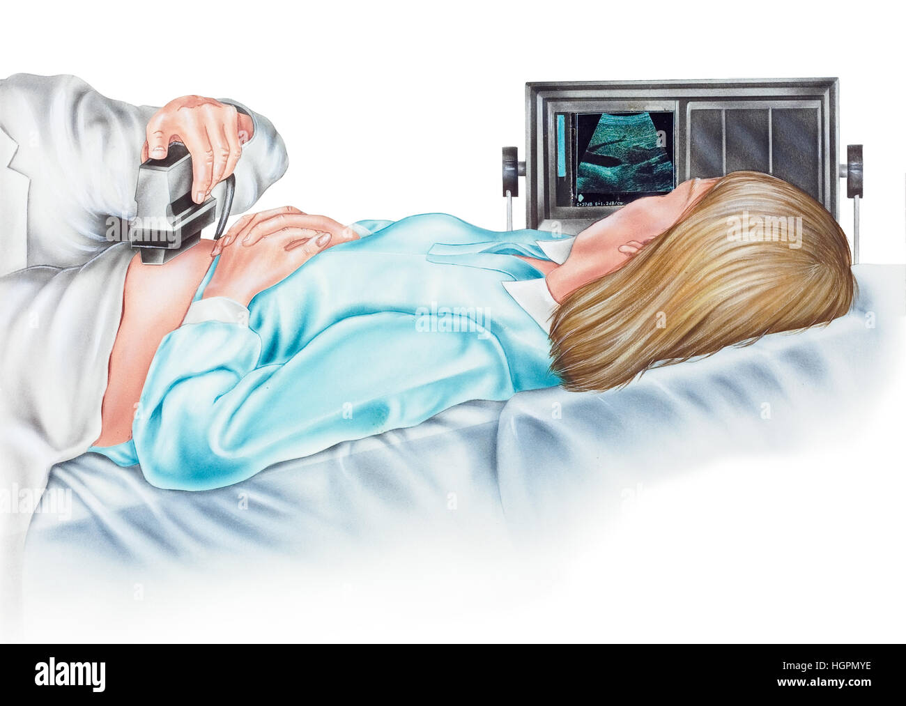 Ultrasonogram (ultrasons) d'une femme enceinte. Cette procédure peut détecter une grossesse ectopique (extra-utérine), anomalies fœtales, l'âge du fœtus, grossesse multiple Banque D'Images