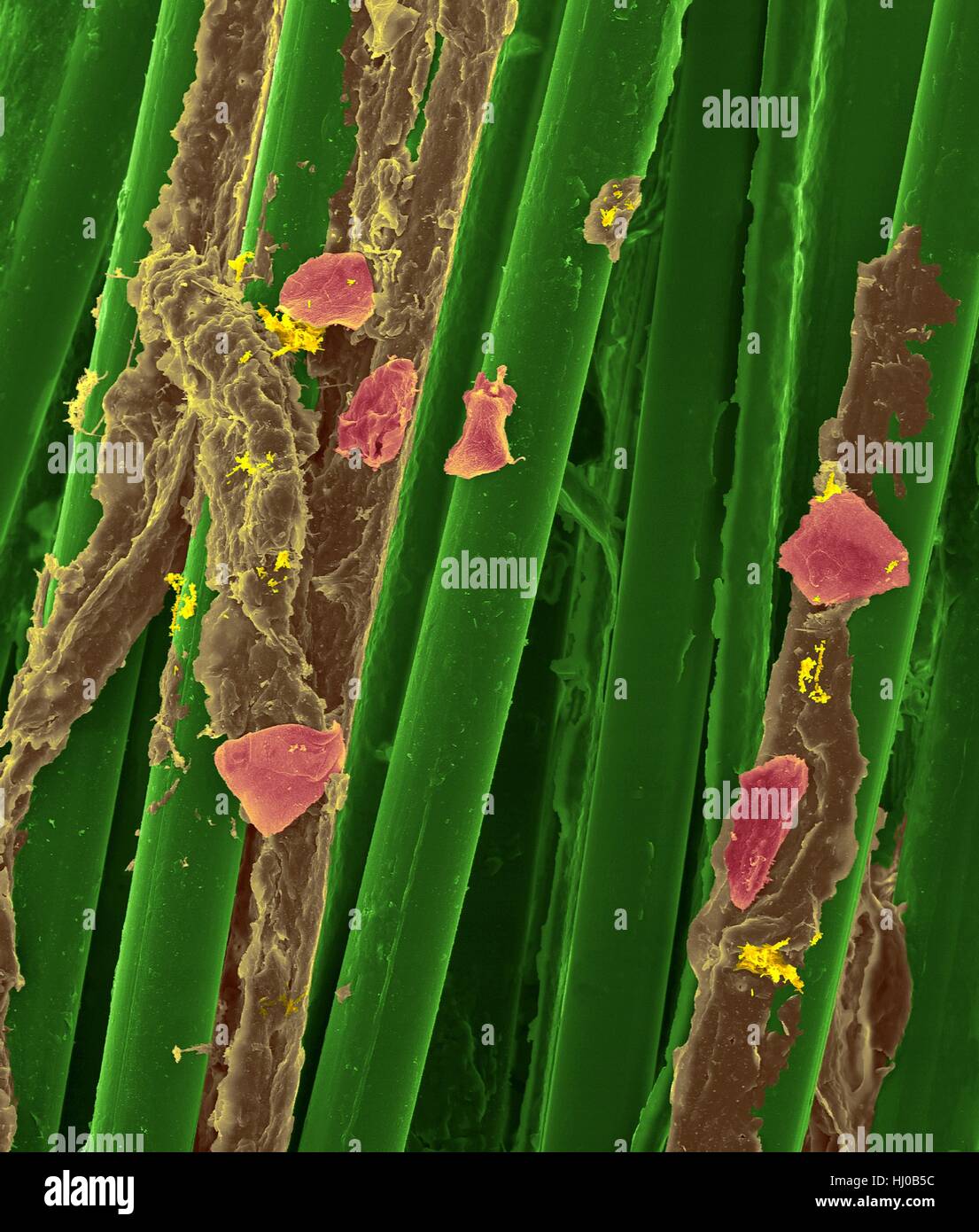 Fil dentaire cire utilisé avec la plaque dentaire (Brown), bactéries (jaune) des cellules de la joue (violet) sur les fibres de soie dentaire (vert),couleur de l'analyse des électrons Microphotographie (SEM) se compose de Plaque.de bactéries biofilm intégrés dans la matrice matrix.glycoprotéine est formé à partir de la salive des sécrétions bactériennes.l Banque D'Images