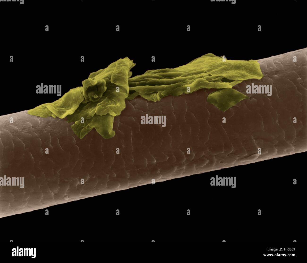 Les pellicules des cheveux,couleur de l'analyse des électrons Microphotographie (SEM).La couche externe des cheveux (la cuticule) a écailles superposées de la kératine.Ces balances sont censés prévenir les poils à nattes ensemble.le cheveu est composé de protéine fibreuse appelée la kératine des cheveux en interne.est divisé en trois gaines concentriques (couches) appelé cortex medulla,cuticule externe.sèche n'est pas le tissu vivant.Les cheveux se développent à partir de la racine des cheveux (ampoule) incrustée dans la peau.La croissance de cheveux se produit lorsque les cellules de l'épiderme se diviser à base des cheveux.L'ampoule n'est pas le tissu vivant.grossissement : X115 lorsque l'axe le plus court imprimé à 25 millimètres. Banque D'Images