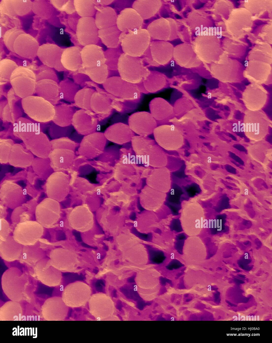 Couleur de l'analyse des électrons Microphotographie (SEM) de la bactérie Streptococcus mutans,entourant polysaccharide glucane de dextran (mucilage).S.mutans est en forme coccoïde,,à Gram positif anaérobies facultatives, bactérie qui fait partie du processus normal de la flore des bactéries de la bouche.Il métabolise la saccharose à l'acide lactique est Banque D'Images