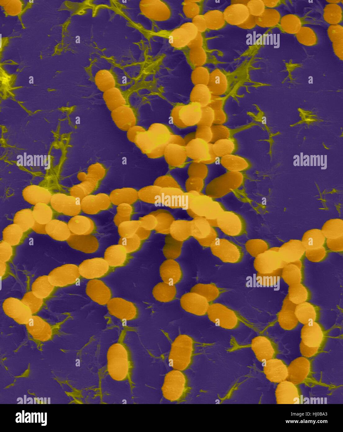 Couleur de l'analyse des électrons Microphotographie (SEM) de Streptococcus thermophilus,,à Gram positif (bactérie procaryote coccoïde).Streptococcus thermophilus (aussi connu sous : Streptococcus salivarius subsp.thermophilus) est facultative que anaérobe appartient au groupe des bactéries lactiques qui transforment le lactose Banque D'Images