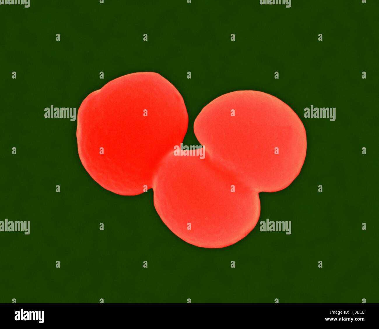 Couleur de l'analyse des électrons Microphotographie (SEM) de Staphylococcus aureus,,à Gram positif,SARM (procaryote coccus divisant) ; provoque l'intoxication alimentaire,le syndrome du choc toxique des infections de plaies de la peau tels que le syndrome de la peau ébouillantée, scarlatine, impétigo érysipèle.le staphylocoque doré résistant à la méthicilline (SARM) Banque D'Images