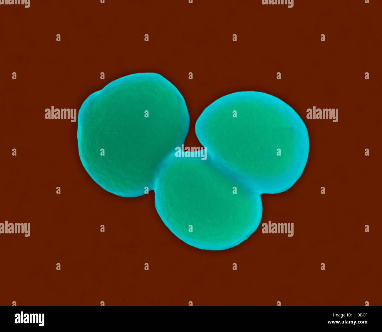 Couleur de l'analyse des électrons Microphotographie (SEM) de Staphylococcus aureus,,à Gram positif,SARM (procaryote coccus divisant) ; provoque l'intoxication alimentaire,le syndrome du choc toxique des infections de plaies de la peau tels que le syndrome de la peau ébouillantée, scarlatine, impétigo érysipèle.le staphylocoque doré résistant à la méthicilline (SARM) Banque D'Images