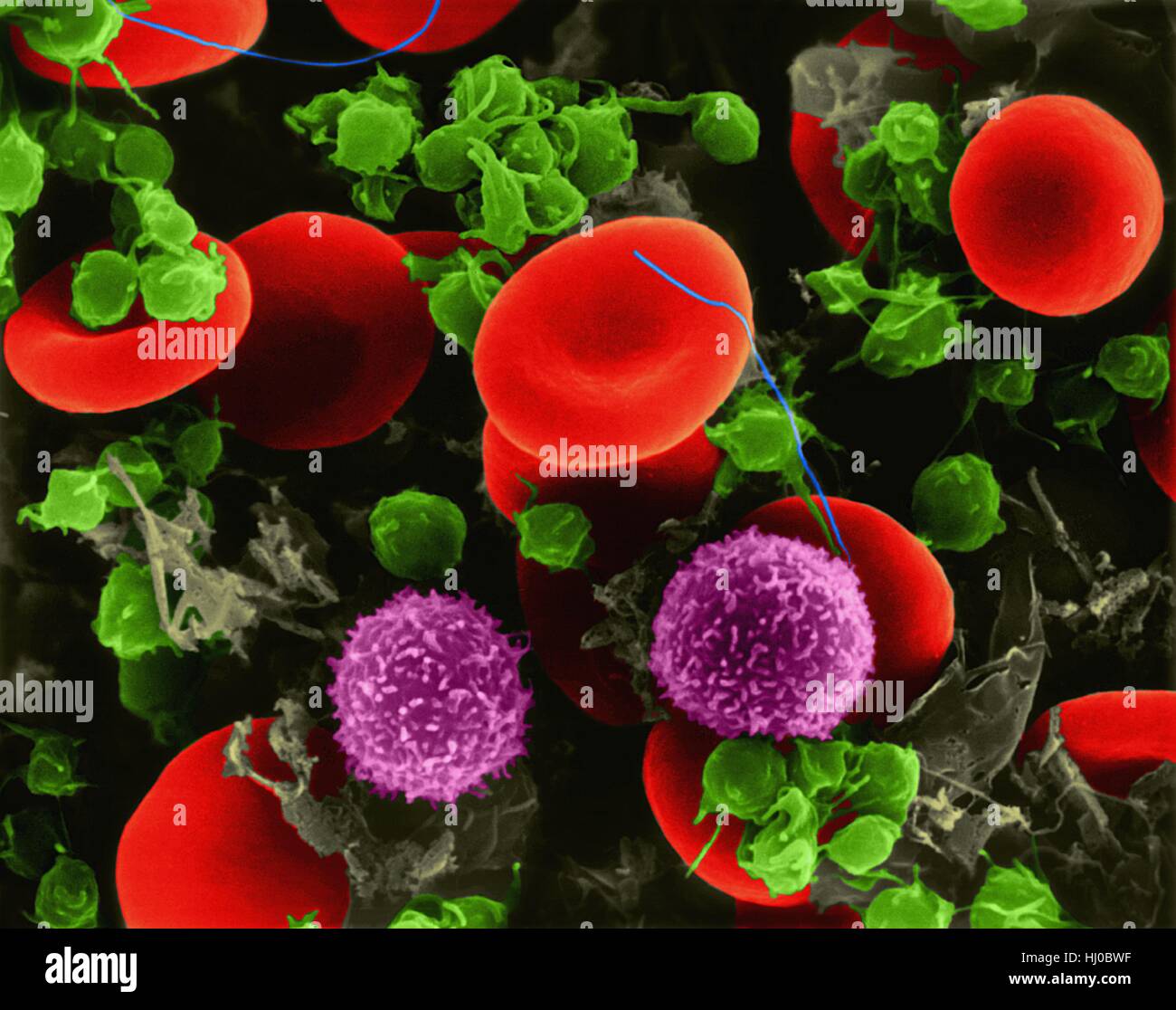 Les globules rouges humains,deux plaquettes lymphocytes T composite,couleur  de l'analyse des électrons Microphotographie (SEM).Les globules rouges  (érythrocytes ou hématies),sont,plus courante de cellules de sang chez les  vertébrés.Ils participent à la ...