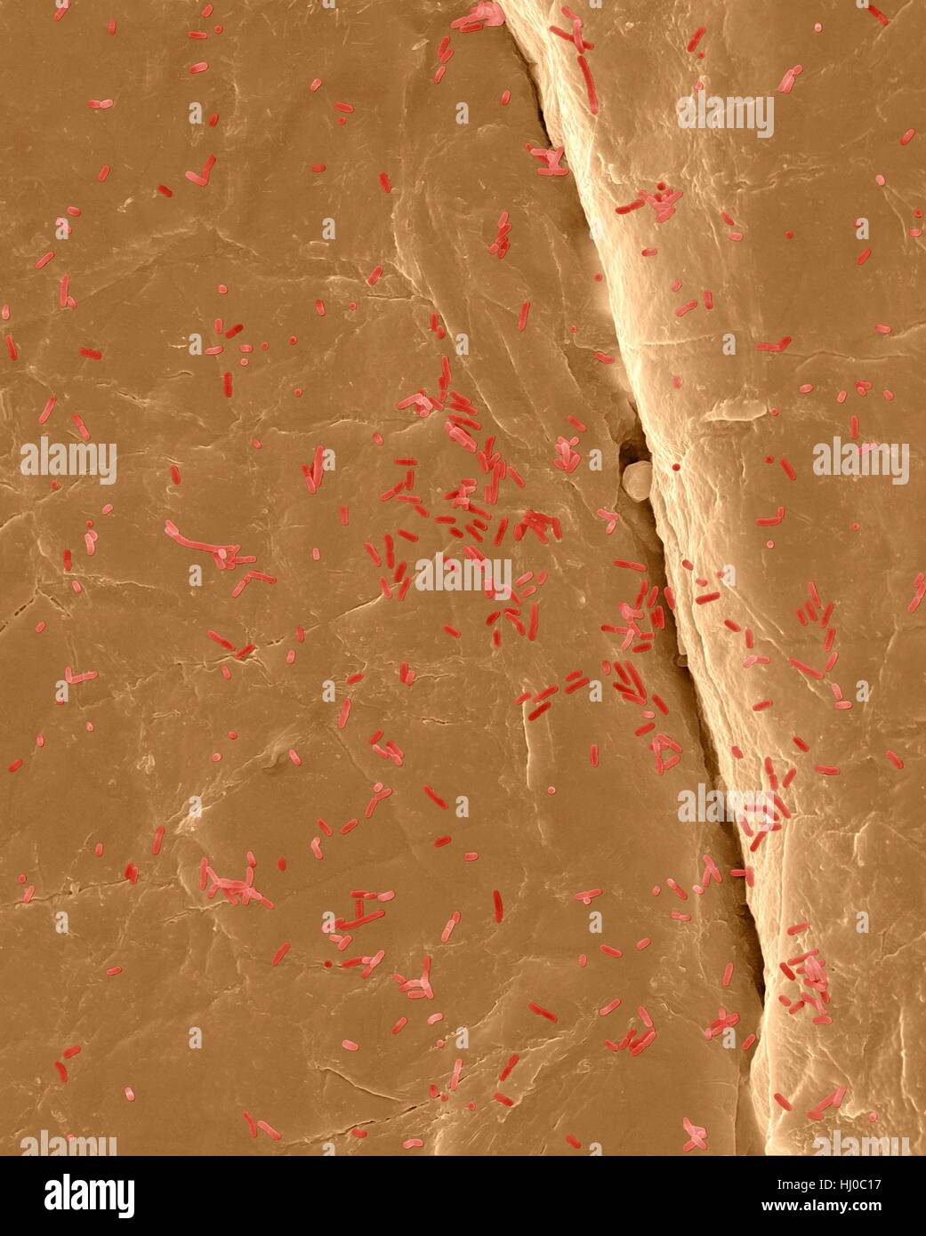 Couleur de l'analyse des électrons Microphotographie (SEM) d'Photocomposite,E.coli sur la surface de la peau humaine.Escherichia coli est,à Gram négatif, anaérobies facultatifs enteric,de génomes procaryotes.Cette bactérie est normalement partie d'animal humain microbiota.La plupart des souches de E. coli sont inoffensives, mais certaines souches peuvent causer de graves problèmes tels que : l'intoxication alimentaire, les infections des voies urinaires, la diarrhée des voyageurs les infections nosocomiales.L'E.coli 0157:H7 est mortelle pour l'homme lorsqu'il est contracté lorsque la viande contaminée est insuffisamment cuite.Grossissement : x200 bactéries ; peau x200 lorsque l'axe le plus court imprimé à 25 millimètres. Banque D'Images