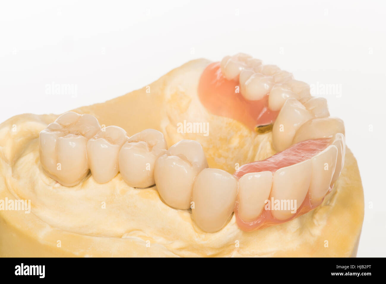 Isoles Les Dents Peu Dentiste Dent Couronne De Dent De La Carie Dentiers Photo Stock Alamy