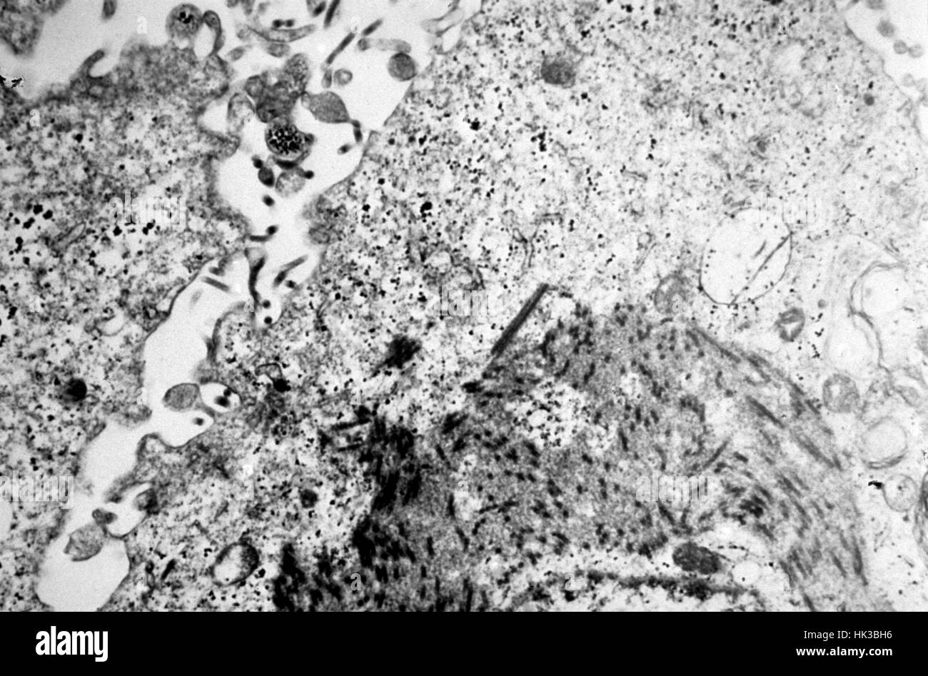 Electronmicrograph montre une section fine contenant le virus Ebola, l'agent causal de la fièvre hémorragique Africaine, 1977. La période d'incubation du virus Ebola varie de 2 à 21 jours avec l'apparition soudaine de la maladie, caractérisée par de la fièvre, maux de tête, des douleurs musculaires et des maux de gorge, faiblesse, et, suivi de la diarrhée, des vomissements et des douleurs à l'estomac. Image courtoisie CDC/Dr. Fred Murphy. Banque D'Images