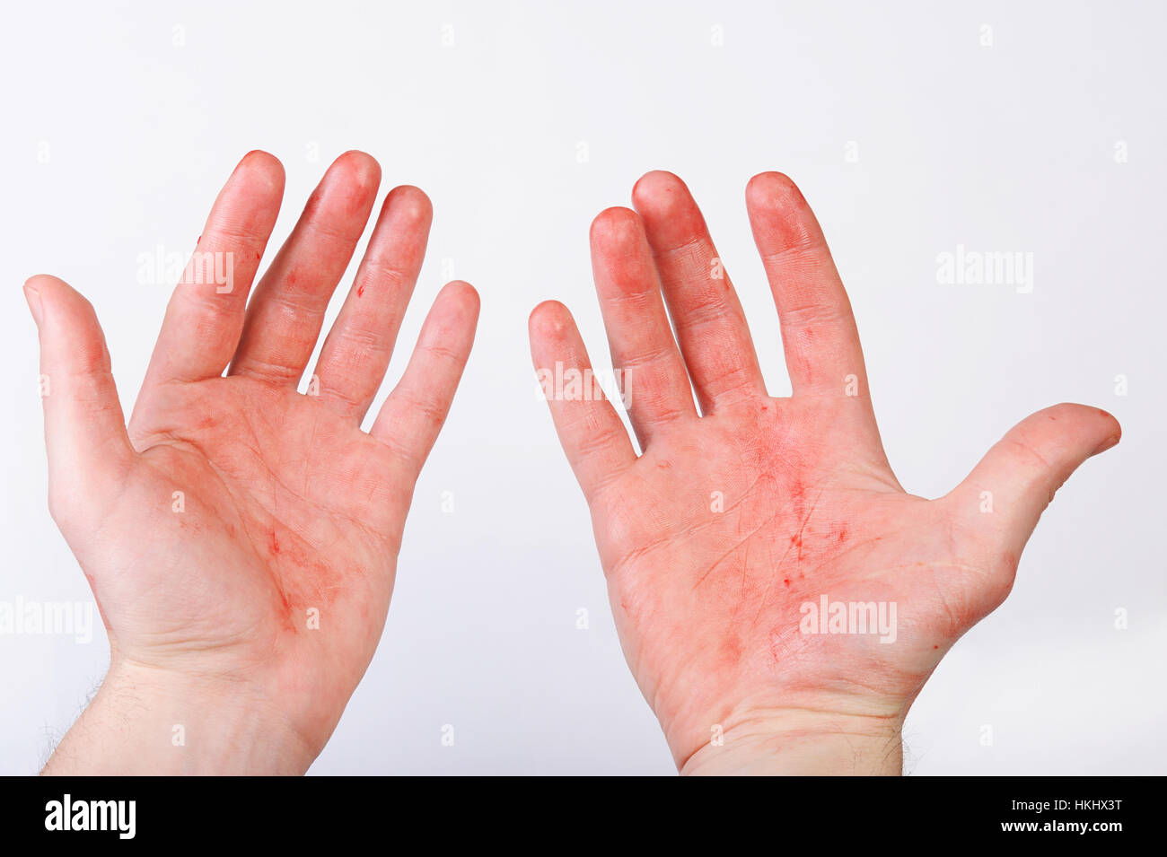 Du sang sur les mains isolé sur fond blanc Banque D'Images