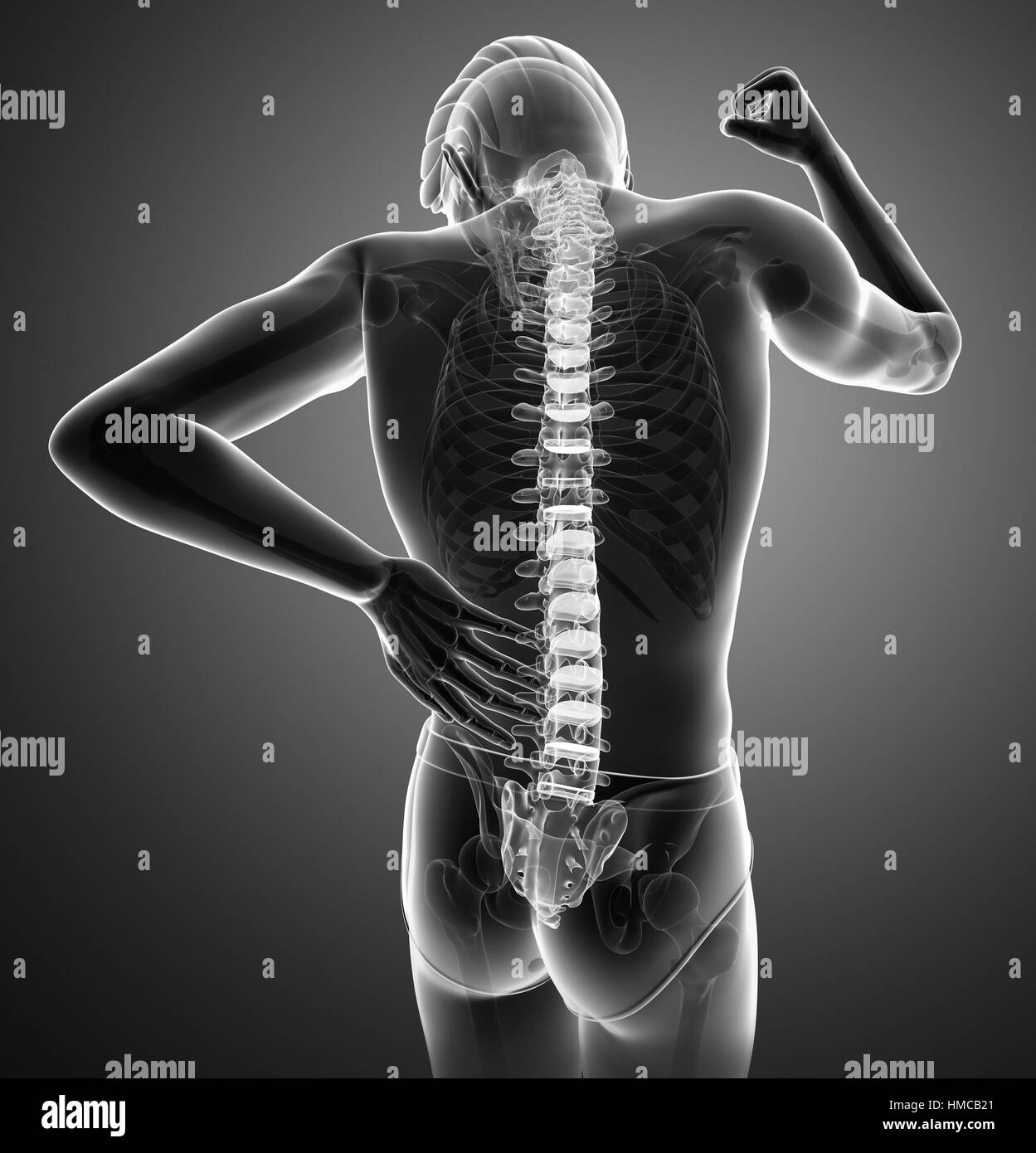 L'anatomie du corps humain avec douleur commune Banque D'Images