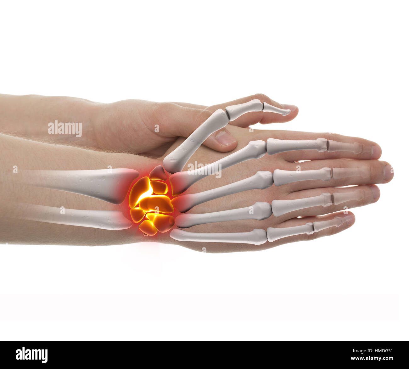 La douleur du poignet - Studio shot avec 3D illustration isolé sur fond blanc Banque D'Images