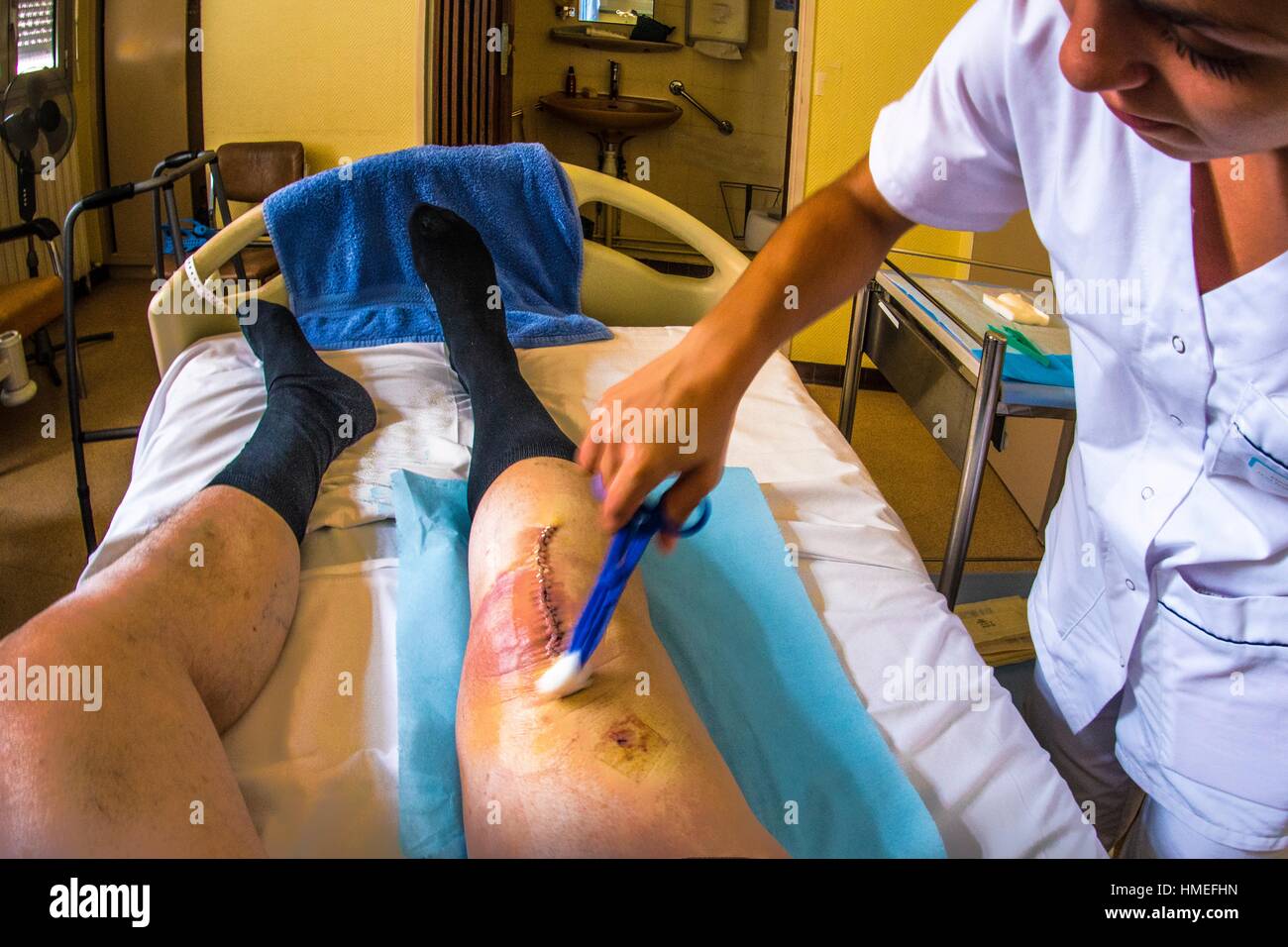 France-Aquitaine-Gironde- à l'hôpital Robert Picqué , un nettoyage de  l'infirmière d'une prothèse de genou cicatric Photo Stock - Alamy