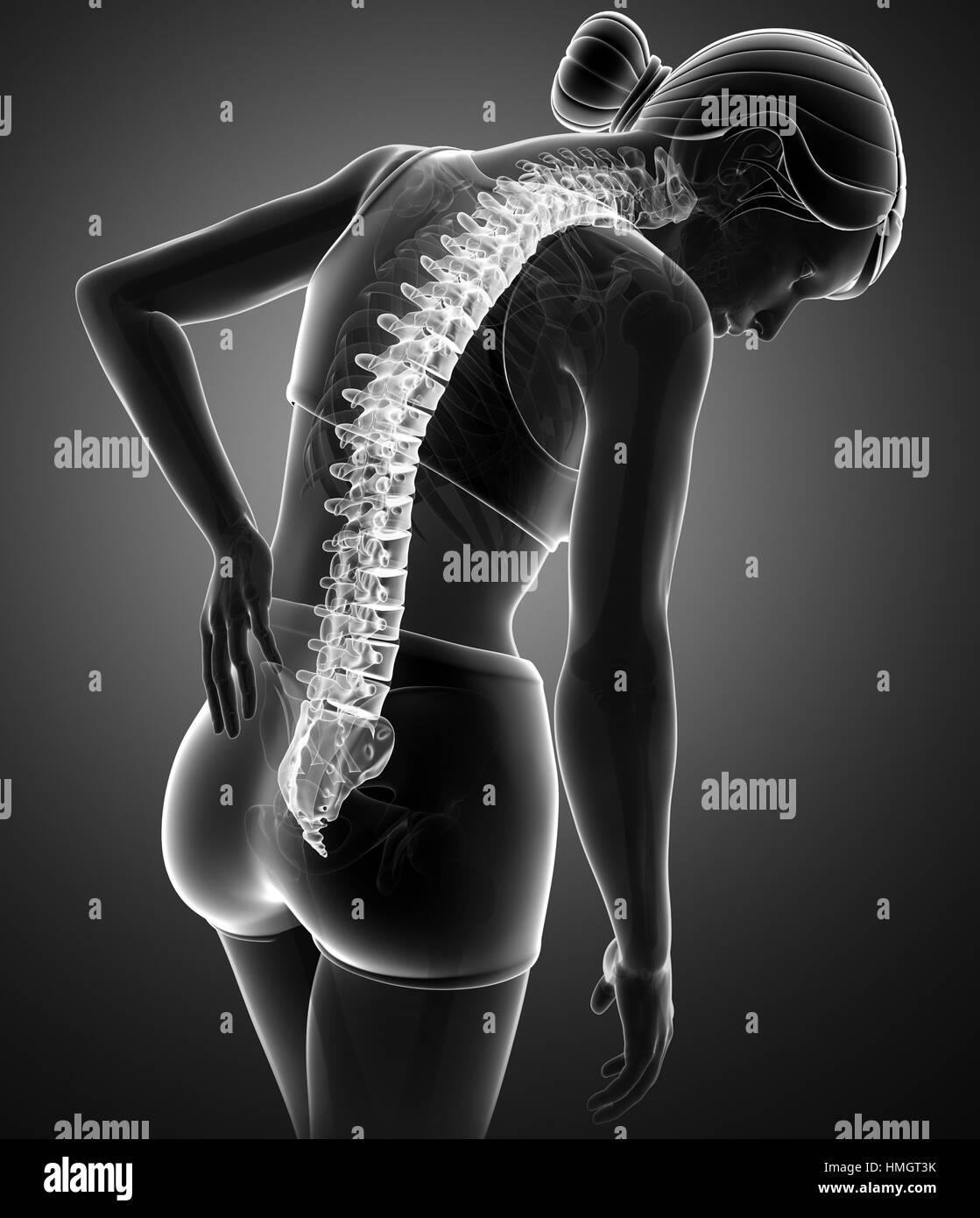 L'anatomie du corps humain avec douleur commune Banque D'Images