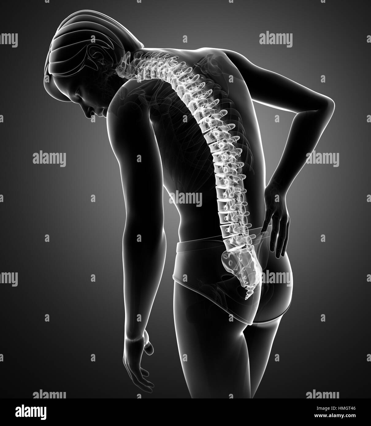 L'anatomie du corps humain avec douleur commune Banque D'Images