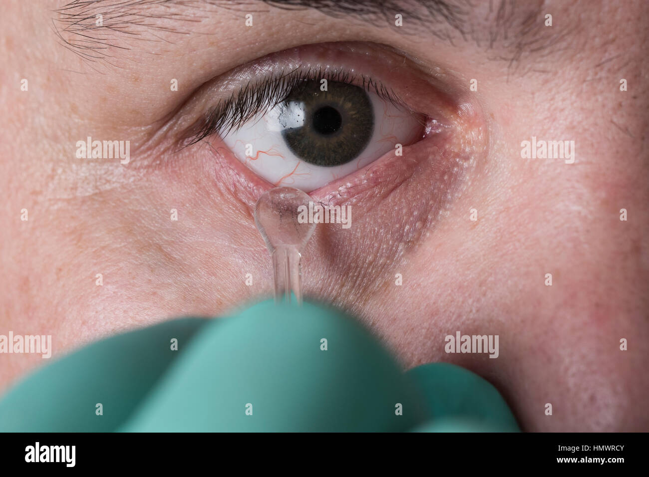 L'extraction des prothèses oculaires en verre prothèse oculaire Banque D'Images