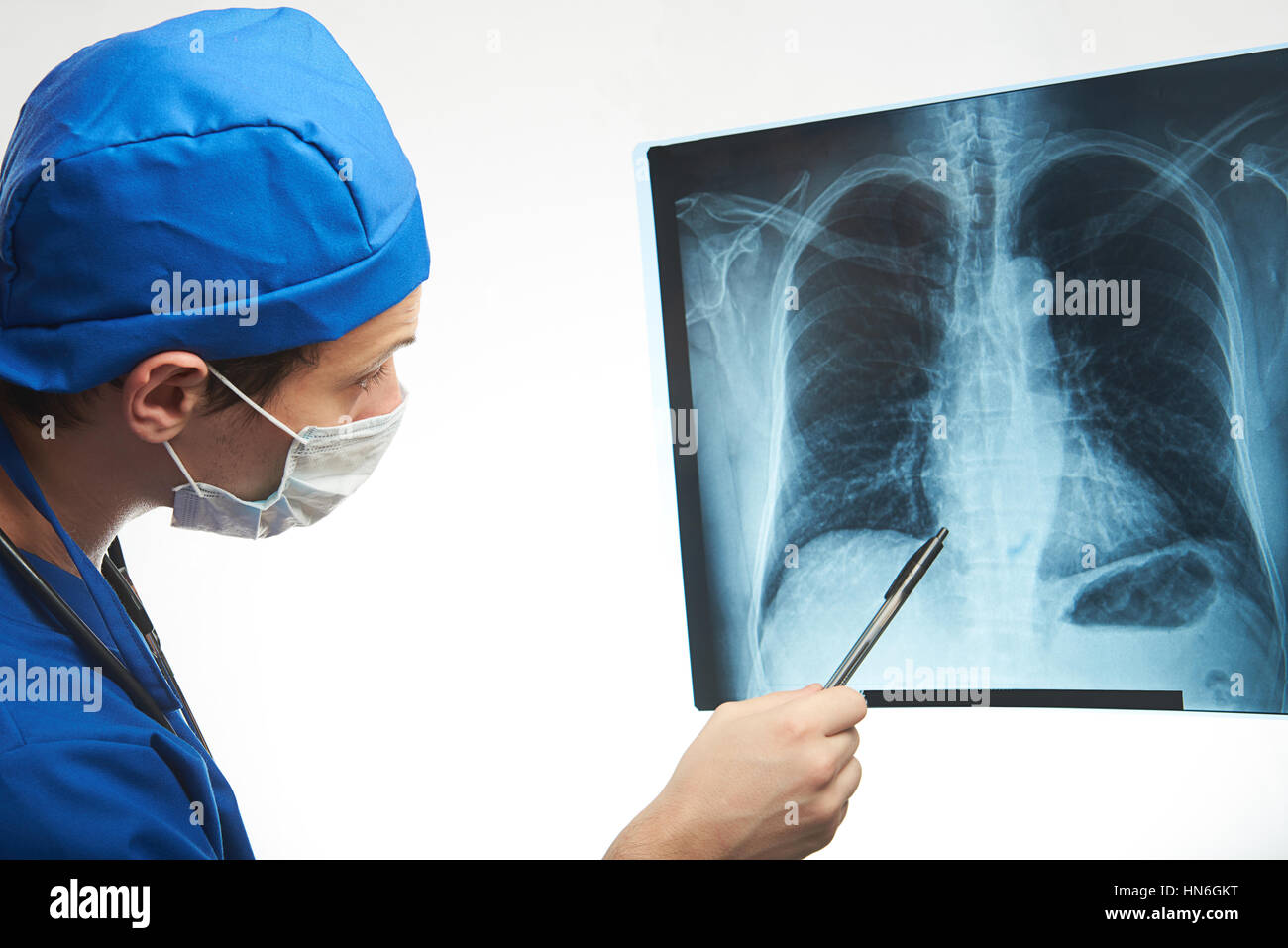 Médecin regarde x-ray photo de poitrine isolated on white Banque D'Images