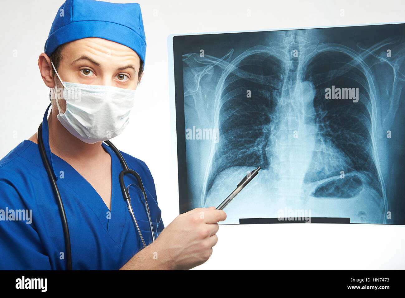 Jeune médecin afficher x-ray de poitrine isolated on white Banque D'Images