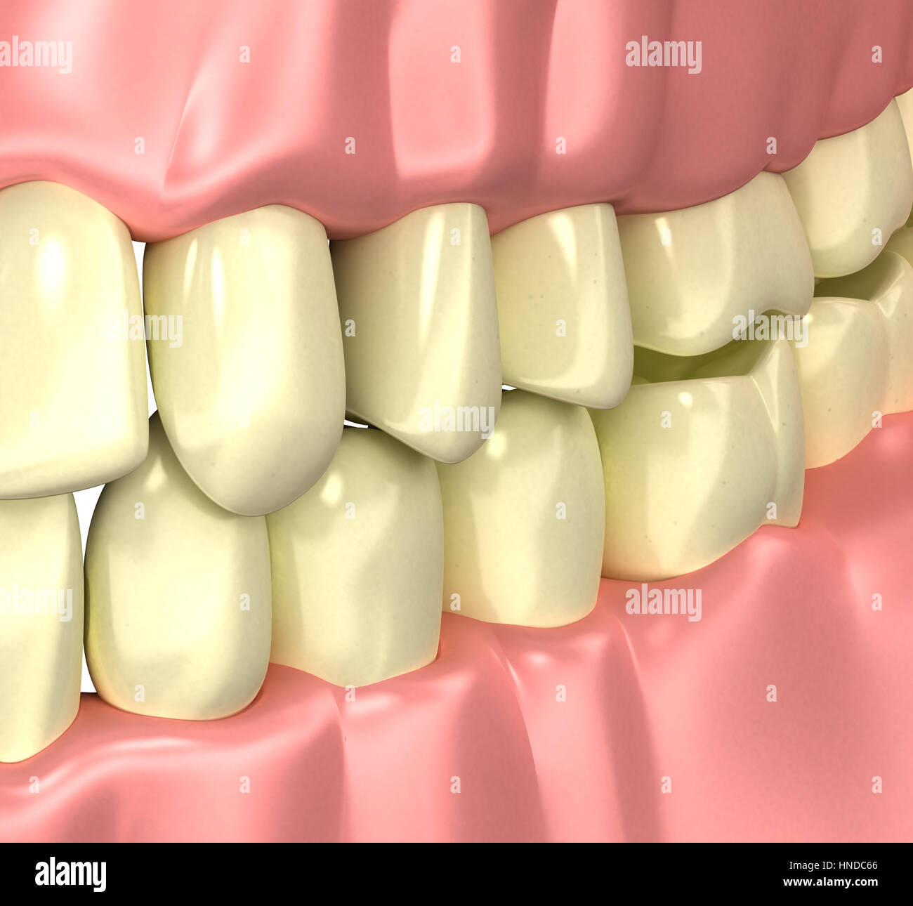 Les fumeurs de mauvaises dents jaunes - concept 3d illustration Banque D'Images